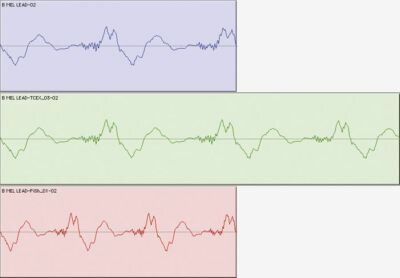 Time Stretching and Pitch-Shifting
